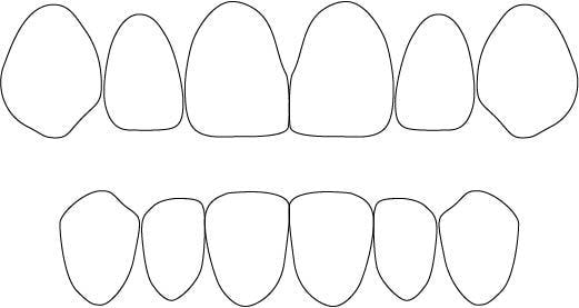 歯式図13