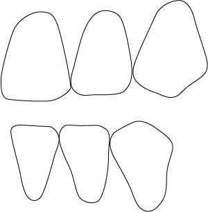 歯式図14